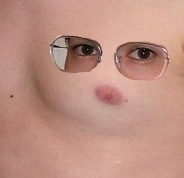 Chris' chest