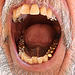 Teeth