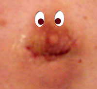 Terry's nipple